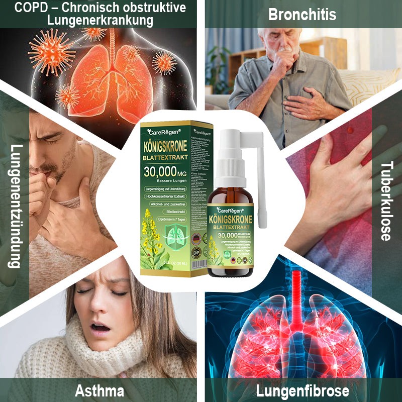 𝗢𝗳𝗳𝗶𝘇𝗶𝗲𝗹𝗹𝗲𝘀 𝗚𝗲𝘀𝗰𝗵ä𝗳𝘁: CareRegen®🪸 𝗕𝗶𝗼𝗹𝗼𝗴𝗶𝘀𝗰𝗵𝗲𝘀 𝗟𝘂𝗻𝗴𝗲𝗻𝗿𝗲𝗶𝗻𝗶𝗴𝘂𝗻𝗴𝘀-𝗜𝗻𝗵𝗮𝗹𝗮𝘁 𝗮𝘂𝘀 𝗞𝗼𝗻𝗶𝗴𝘀𝗸𝗲𝗿𝘇𝗲𝗻𝗯𝗹𝗮𝘁𝘁-𝗘𝘅𝘁𝗿𝗮𝗸𝘁 𝐖𝐢𝐬𝐬𝐞𝐧𝐬𝐜𝐡𝐚𝐟𝐭𝐥𝐢𝐜𝗵 𝐛𝐞𝐰𝐢𝐞𝐬𝐞𝐧𝗲, 𝐡𝗼𝗰𝐡𝐤𝗼𝗻𝐳𝐞𝐧𝐭𝐫𝐢𝐞𝐫𝐭𝐞 𝐅𝐨𝐫𝐦𝐞𝐥, 𝐝𝐢𝐞 𝐇𝐮𝐬𝐭𝐞𝐧, 𝐒𝐜𝐡𝐥𝐞𝐢𝐦, 𝐀𝐬𝐭𝐡𝐦𝐚 𝐮𝐧𝐝 𝐂𝐎𝐏𝐃 𝐥𝗶𝗻𝗱𝐞𝐫𝐭 — 𝐟𝗼𝐫𝐦𝐭 𝐝𝐚𝐬 𝐀𝐭𝐞𝐦𝐞𝐧 𝐞𝐢𝐧𝐟𝐚𝐜𝐡𝐞𝐫 𝐮𝐧𝐝 𝐬𝐜𝐡𝐧𝐞𝐥𝐥𝐞𝐫. 🩵
