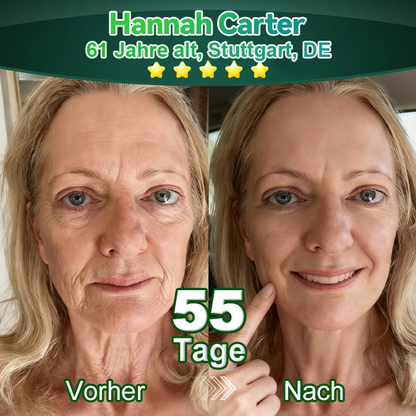 Awzlove® Luxuriöses Anti-Cellulite-Massageöl mit Kollagen und Stammzellen (🔥Nur für kurze Zeit 70 % reduziert!) 🥑🥑