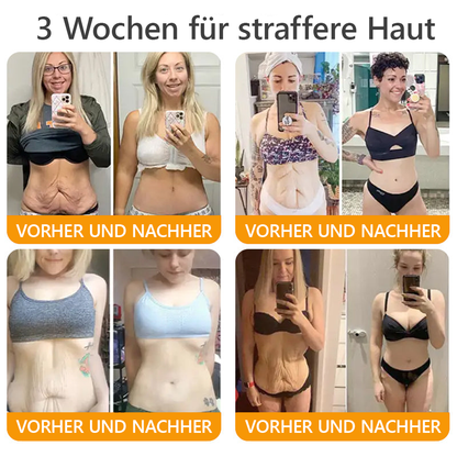 Awzlove® Luxuriöses Kollagen- & Pflanzenstammzellen Anti-Cellulite-Massageöl 🎉 (🔥 Nur für kurze Zeit: 70 % Rabatt!)