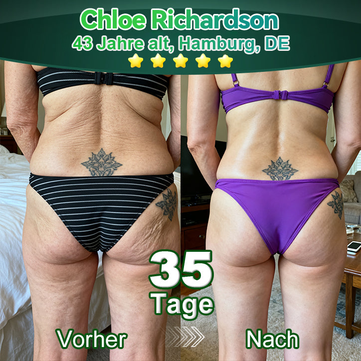 Awzlove® Luxuriöses Anti-Cellulite-Massageöl mit Kollagen und Stammzellen (🔥Nur für kurze Zeit 70 % reduziert!) 🌻🌻