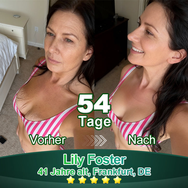 Awzlove® Luxuriöses Anti-Cellulite-Massageöl mit Kollagen und Stammzellen (🔥Nur für kurze Zeit 70 % reduziert!) 🌻🌻