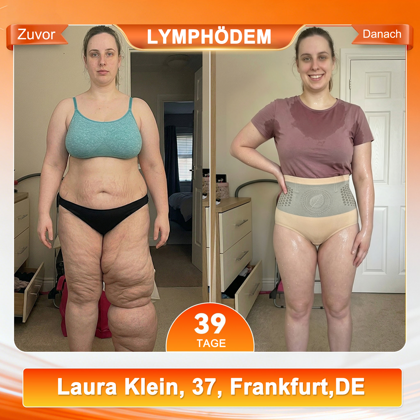 🎇🩳𝐎𝐟𝐟𝐢𝐜𝐢𝐚𝐥 𝐁𝐫𝐚𝐧𝐝 𝐒𝐭𝐨𝐫𝐞 |✅ EXPECTSKY® 2026 Moringa- & Berberin-4-in-1-Shorts zur Körperformung und Fettverbrennung mit Mikropartikeln💚💝
