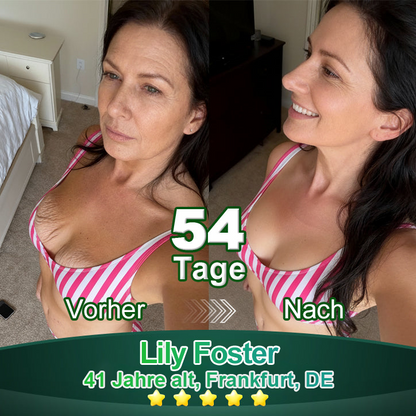 Awzlove® Luxuriöses Anti-Cellulite-Massageöl mit Kollagen und Stammzellen (🔥Nur für kurze Zeit 70 % reduziert!) 🥑🥑