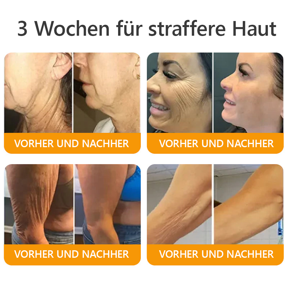 Awzlove® Luxuriöses Kollagen- & Pflanzenstammzellen Anti-Cellulite-Massageöl 🎉 (🔥 Nur für kurze Zeit: 70 % Rabatt!)