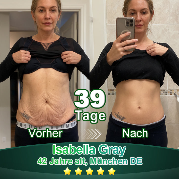 Awzlove® Luxuriöses Anti-Cellulite-Massageöl mit Kollagen und Stammzellen (🔥Nur für kurze Zeit 70 % reduziert!) 🥑🥑