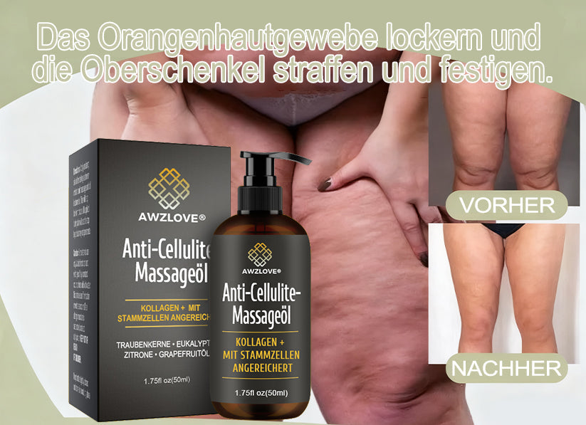 Awzlove® Luxuriöses Kollagen- & Pflanzenstammzellen Anti-Cellulite-Massageöl 🎉 (🔥 Nur für kurze Zeit: 70 % Rabatt!)